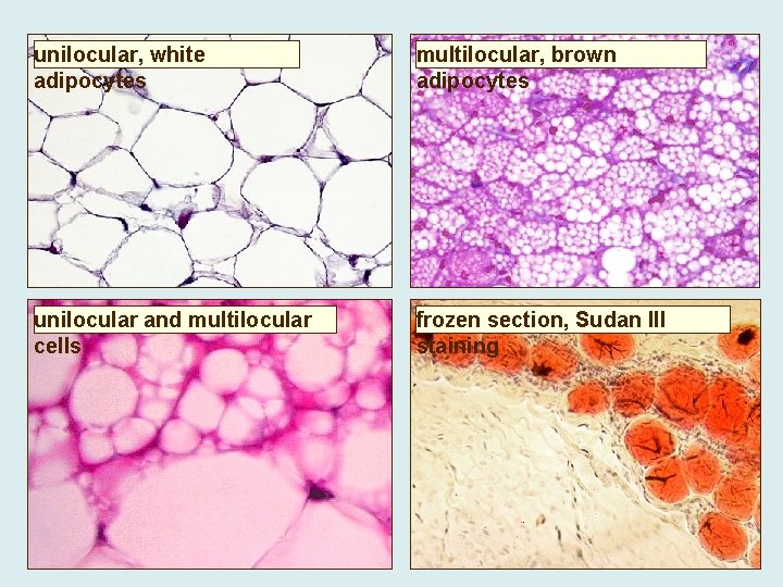 unilocular, white adipocytes multilocular, brown adipocytes unilocular and multilocular cells frozen section, Sudan III