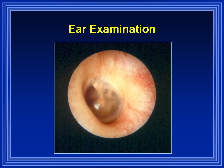 Ear Examination 