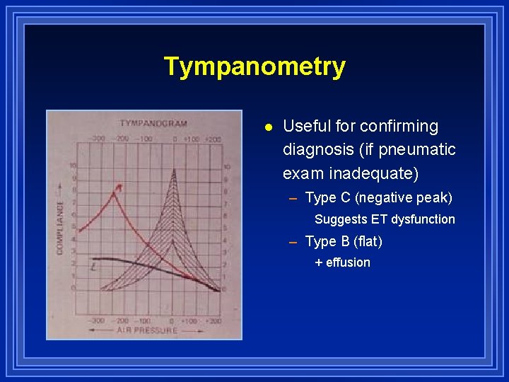 Tympanometry l Useful for confirming diagnosis (if pneumatic exam inadequate) – Type C (negative