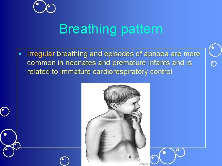 Breathing pattern • Irregular breathing and episodes of apnoea are more common in neonates