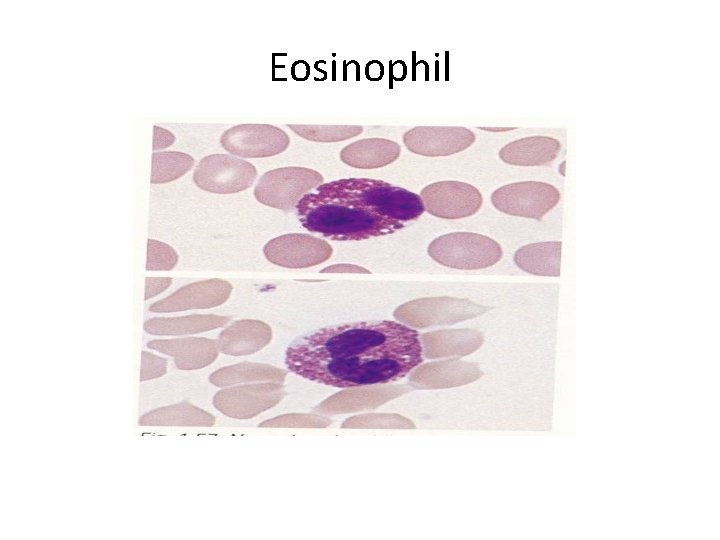 Eosinophil 