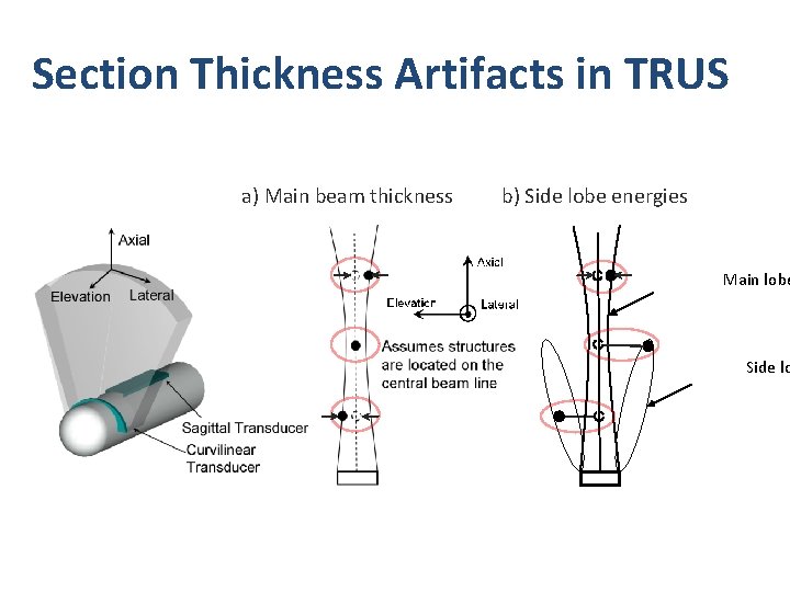 Section Thickness Artifacts in TRUS a) Main beam thickness b) Side lobe energies Main