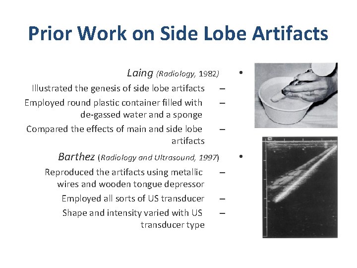 Prior Work on Side Lobe Artifacts Laing (Radiology, 1982) Illustrated the genesis of side