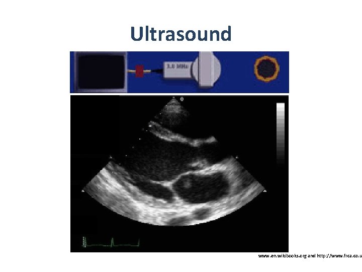 Ultrasound www. en. wikibooks. org and http: //www. frca. co. u 