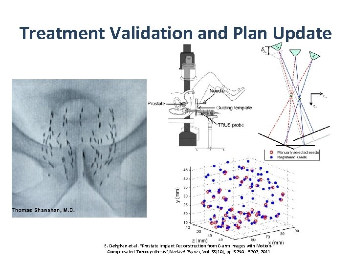 Treatment Validation and Plan Update E. Dehghan et al. “Prostate Implant Reconstruction from C-arm
