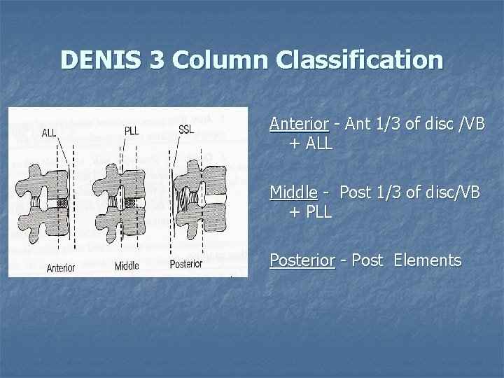 DENIS 3 Column Classification Anterior - Ant 1/3 of disc /VB + ALL Middle