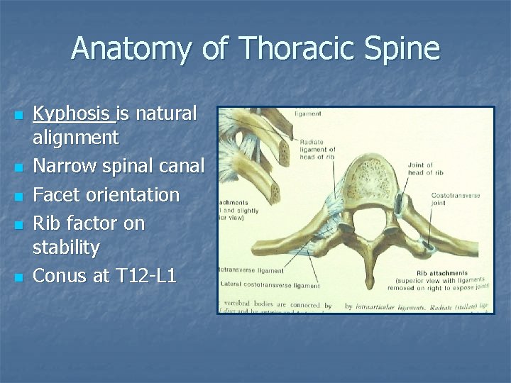 Anatomy of Thoracic Spine n n n Kyphosis is natural alignment Narrow spinal canal