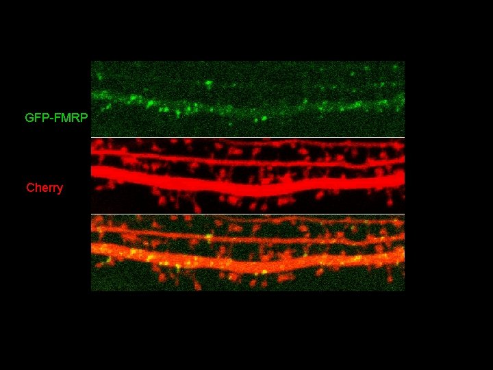 GFP-FMRP Cherry 