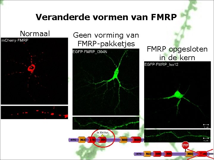 Veranderde vormen van FMRP Normaal Geen vorming van FMRP-pakketjes FMRP opgesloten in de kern