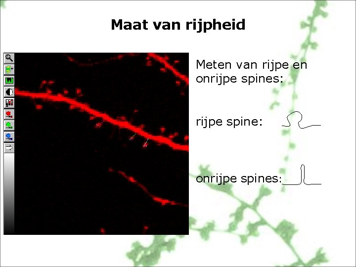 Maat van rijpheid Meten van rijpe en onrijpe spines: rijpe spine: onrijpe spines: 