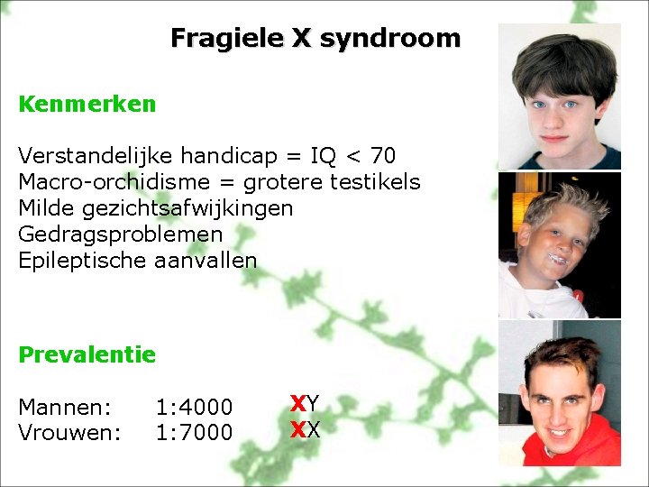 Fragiele X syndroom Kenmerken Verstandelijke handicap = IQ < 70 Macro-orchidisme = grotere testikels