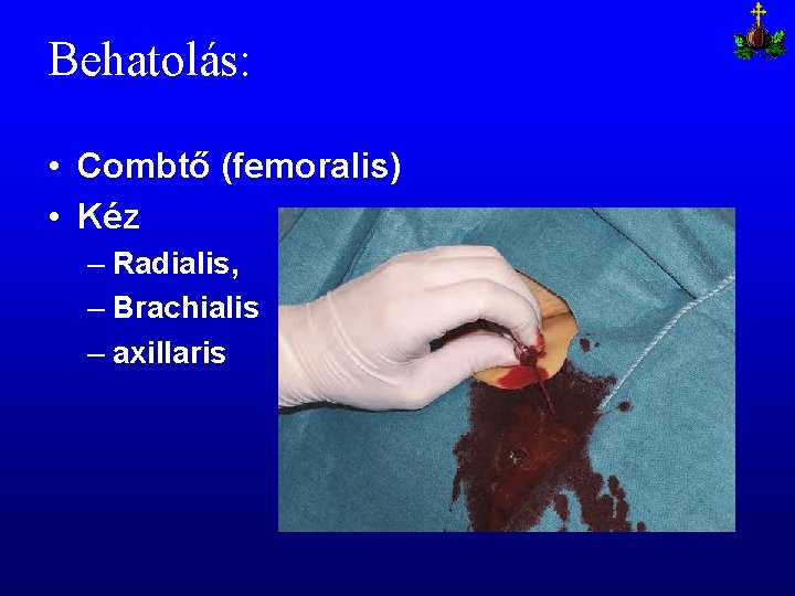 Behatolás: • Combtő (femoralis) • Kéz – Radialis, – Brachialis – axillaris 