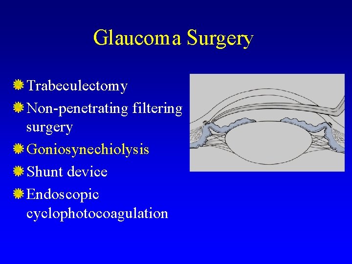 Glaucoma Surgery Trabeculectomy Non-penetrating filtering surgery Goniosynechiolysis Shunt device Endoscopic cyclophotocoagulation 