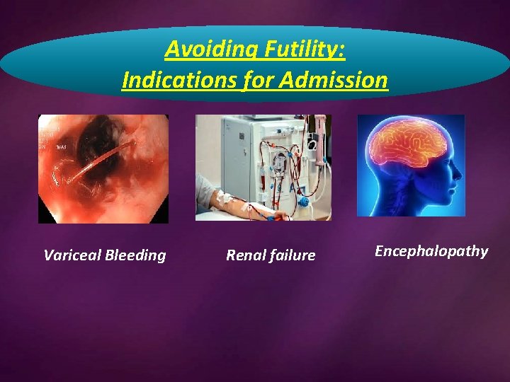 Avoiding Futility: Indications for Admission Variceal Bleeding Renal failure Encephalopathy 