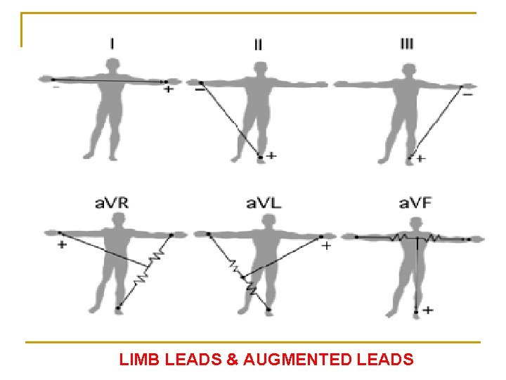 LIMB LEADS & AUGMENTED LEADS 