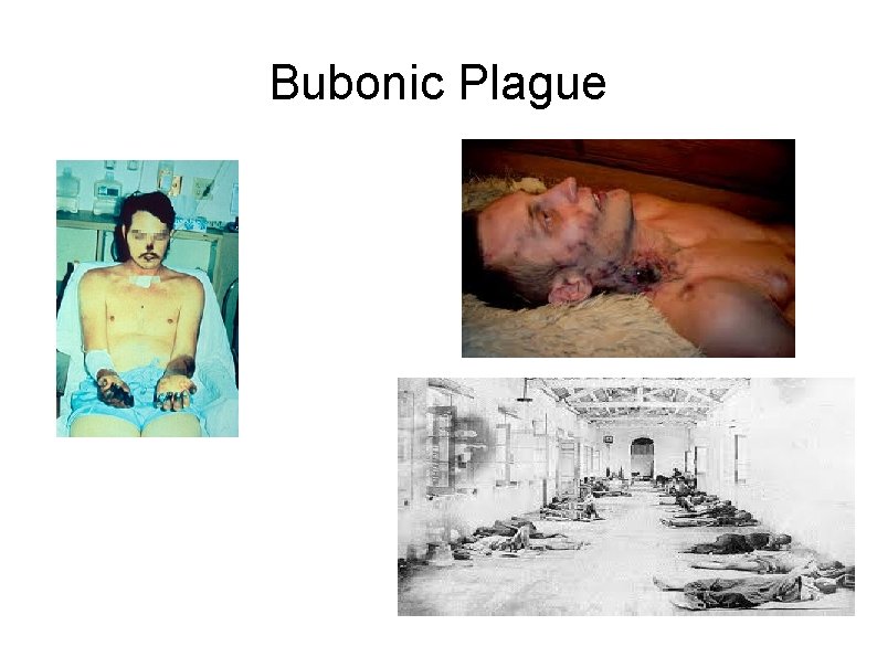 Bubonic Plague 