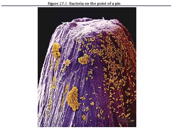 Figure 27. 0 Bacteria on the point of a pin 