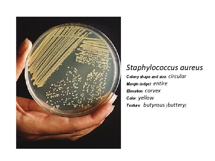 Staphylococcus aureus Colony shape and size: circular Margin (edge): entire Elevation: corvex Color: yellow