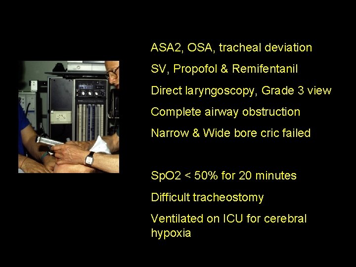 ASA 2, OSA, tracheal deviation SV, Propofol & Remifentanil Direct laryngoscopy, Grade 3 view ASA 2, OSA, tracheal deviation SV, Propofol & Remifentanil Direct laryngoscopy, Grade 3 view