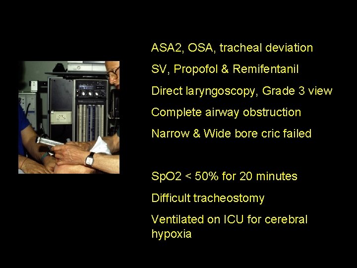 ASA 2, OSA, tracheal deviation SV, Propofol & Remifentanil Direct laryngoscopy, Grade 3 view