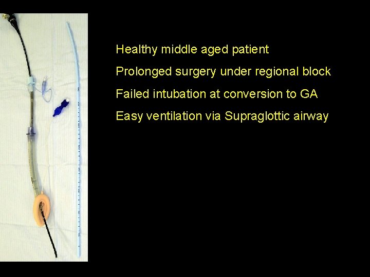 Healthy middle aged patient Prolonged surgery under regional block Failed intubation at conversion to