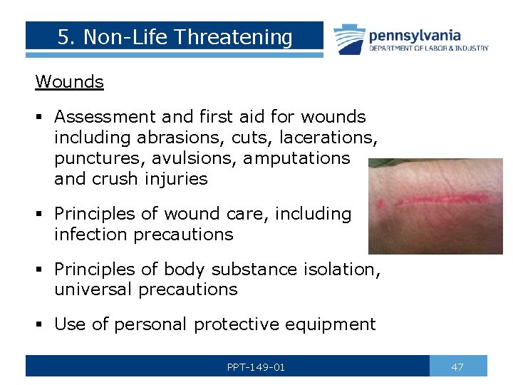 5. Non-Life Threatening Wounds § Assessment and first aid for wounds including abrasions, cuts,
