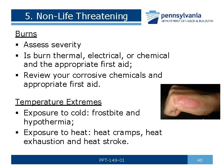 5. Non-Life Threatening Burns § Assess severity § Is burn thermal, electrical, or chemical