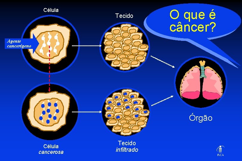 Célula Tecido O que é câncer? Agente cancerígeno Órgão Célula cancerosa Tecido infiltrado 