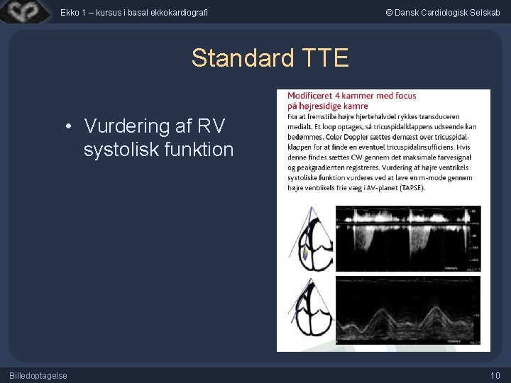 Ekko 1 – kursus i basal ekkokardiografi © Dansk Cardiologisk Selskab Standard TTE •