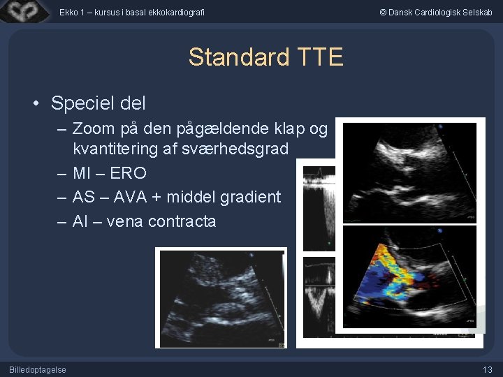 Ekko 1 – kursus i basal ekkokardiografi © Dansk Cardiologisk Selskab Standard TTE •