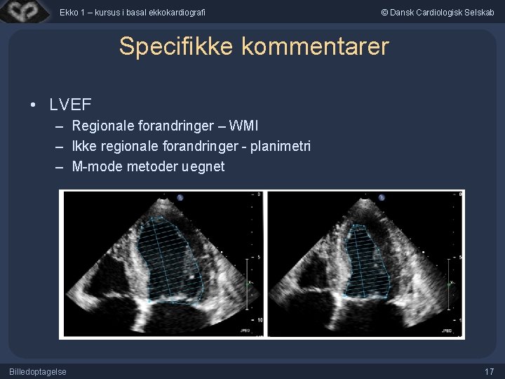 Ekko 1 – kursus i basal ekkokardiografi © Dansk Cardiologisk Selskab Specifikke kommentarer •