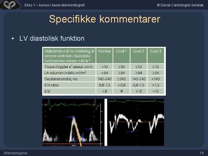 Ekko 1 – kursus i basal ekkokardiografi © Dansk Cardiologisk Selskab Specifikke kommentarer •