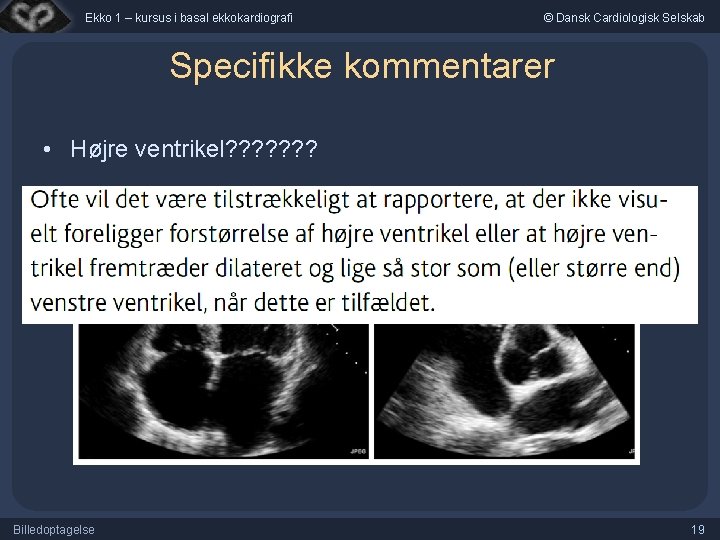 Ekko 1 – kursus i basal ekkokardiografi © Dansk Cardiologisk Selskab Specifikke kommentarer •