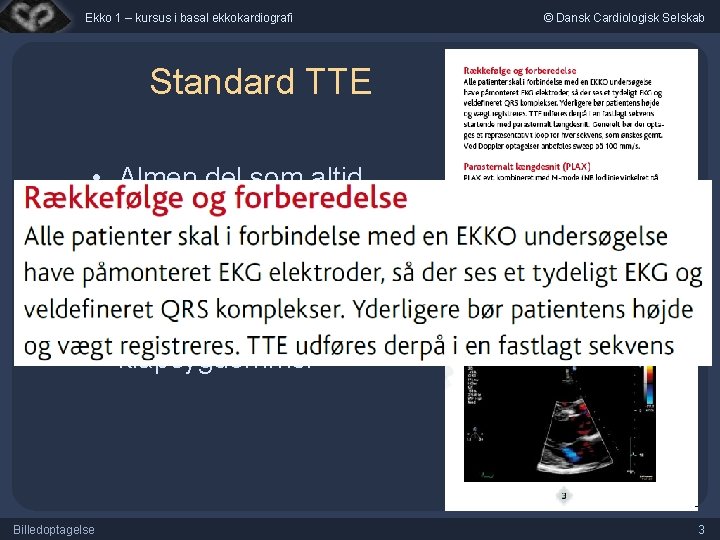 Ekko 1 – kursus i basal ekkokardiografi © Dansk Cardiologisk Selskab Standard TTE •