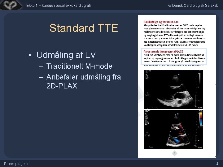 Ekko 1 – kursus i basal ekkokardiografi © Dansk Cardiologisk Selskab Standard TTE •