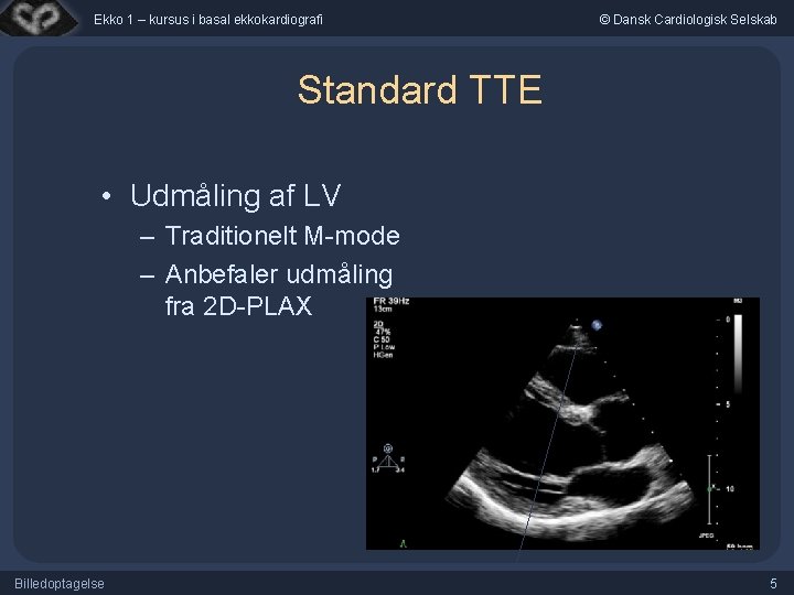 Ekko 1 – kursus i basal ekkokardiografi © Dansk Cardiologisk Selskab Standard TTE •