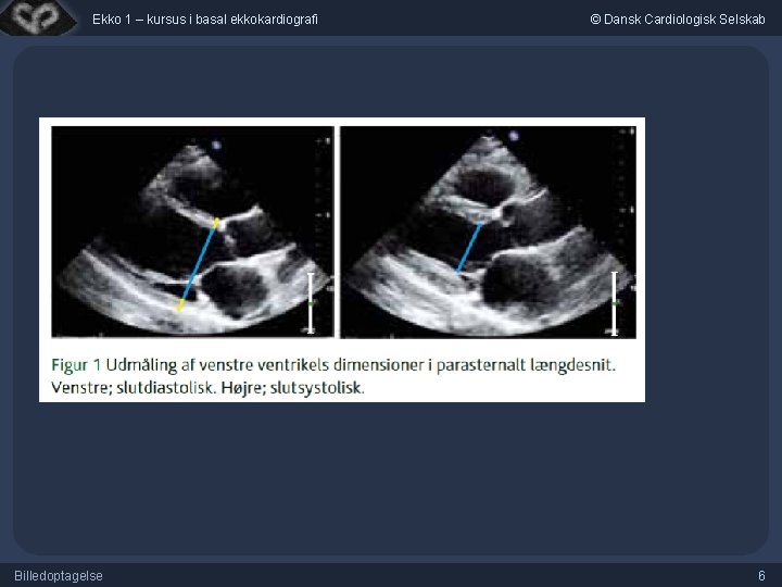 Ekko 1 – kursus i basal ekkokardiografi Billedoptagelse © Dansk Cardiologisk Selskab 6 