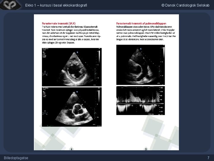 Ekko 1 – kursus i basal ekkokardiografi Billedoptagelse © Dansk Cardiologisk Selskab 7 