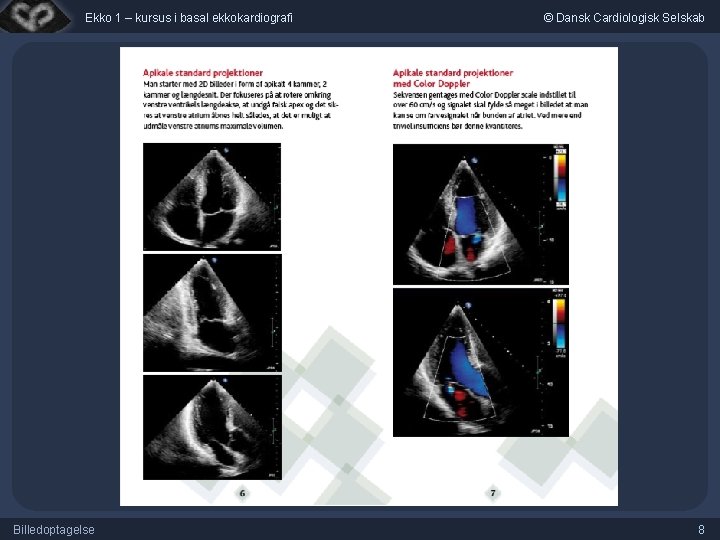 Ekko 1 – kursus i basal ekkokardiografi Billedoptagelse © Dansk Cardiologisk Selskab 8 