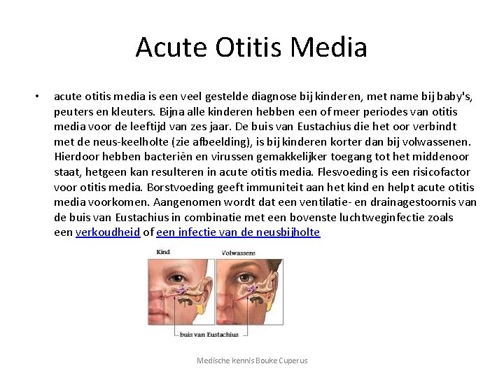 Acute Otitis Media • acute otitis media is een veel gestelde diagnose bij kinderen,