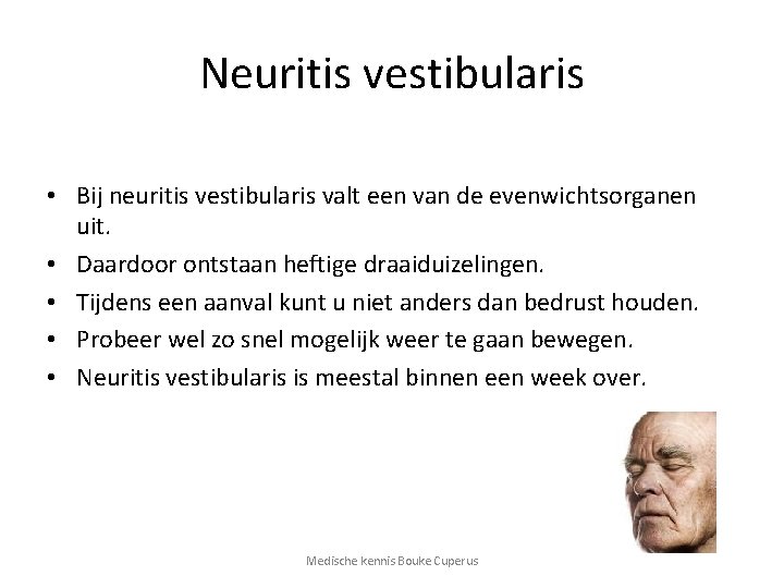 Neuritis vestibularis • Bij neuritis vestibularis valt een van de evenwichtsorganen uit. • Daardoor