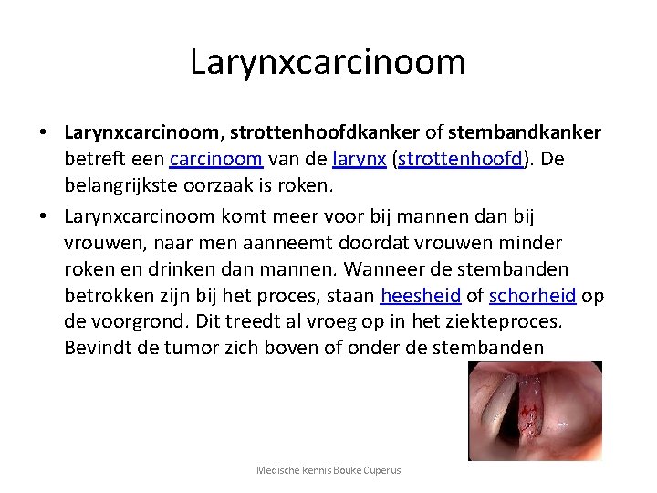 Larynxcarcinoom • Larynxcarcinoom, strottenhoofdkanker of stembandkanker betreft een carcinoom van de larynx (strottenhoofd). De