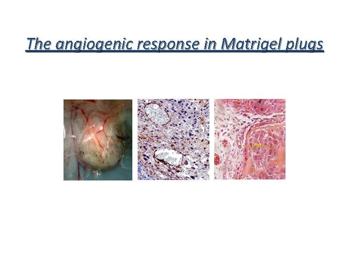 The angiogenic response in Matrigel plugs 