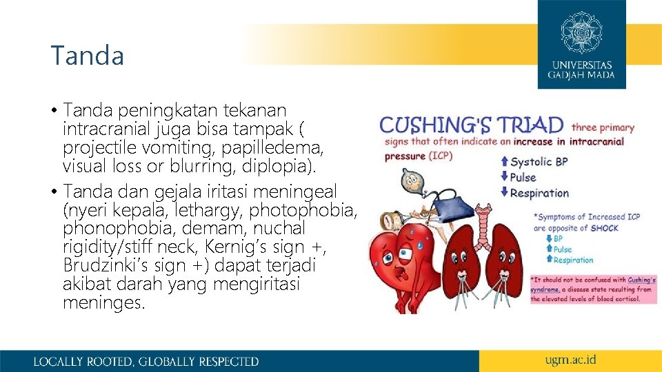 Tanda • Tanda peningkatan tekanan intracranial juga bisa tampak ( projectile vomiting, papilledema, visual