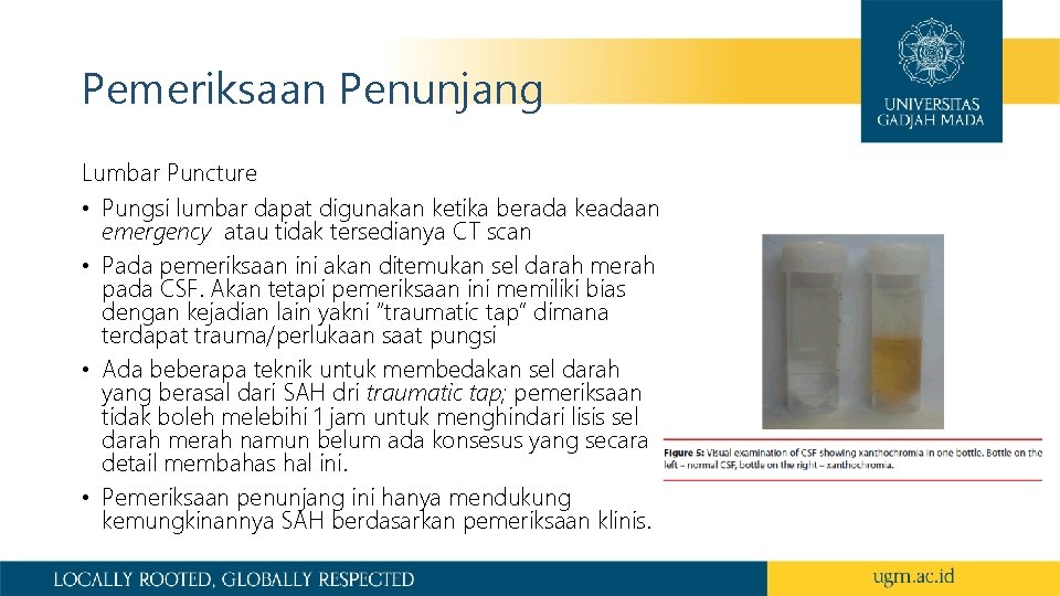 Pemeriksaan Penunjang Lumbar Puncture • Pungsi lumbar dapat digunakan ketika berada keadaan emergency atau