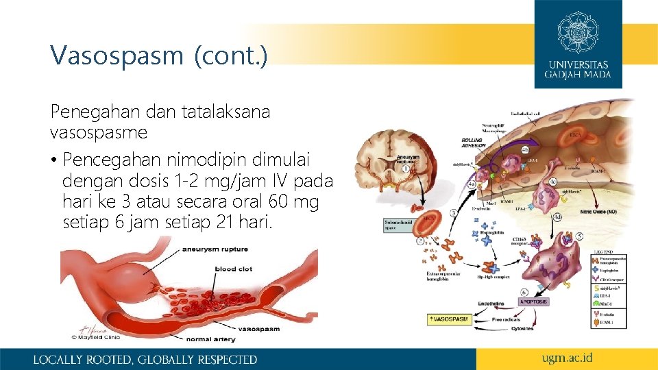 Vasospasm (cont. ) Penegahan dan tatalaksana vasospasme • Pencegahan nimodipin dimulai dengan dosis 1