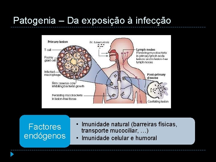 Patogenia – Da exposição à infecção Factores endógenos • Imunidade natural (barreiras físicas, transporte