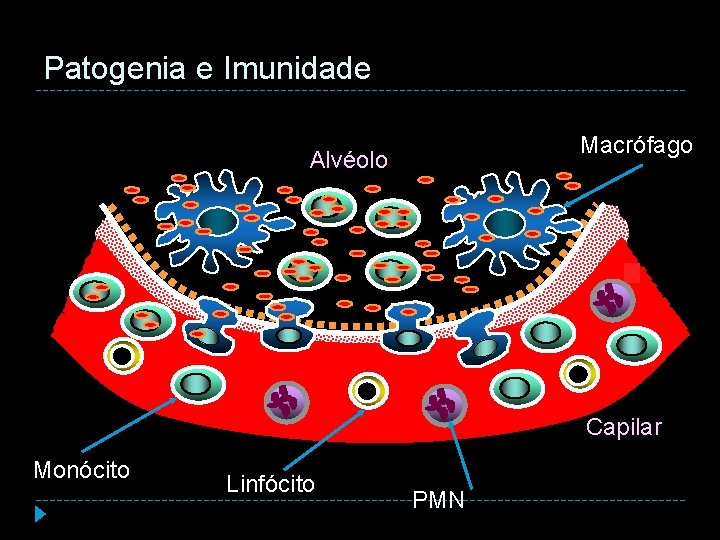 Patogenia e Imunidade Macrófago Alvéolo Capilar Monócito Linfócito PMN 