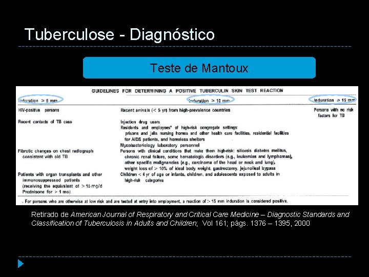 Tuberculose - Diagnóstico Teste de Mantoux Retirado de American Journal of Respiratory and Critical