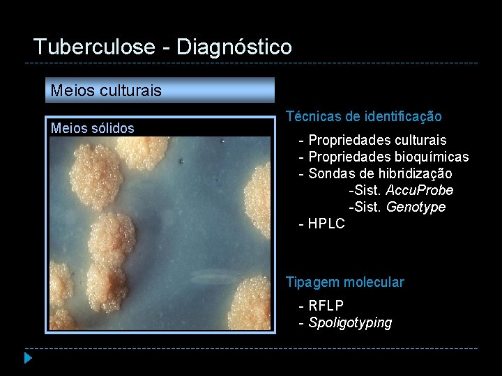 Tuberculose - Diagnóstico Meios culturais Meios sólidos - S > exame directo (10 a